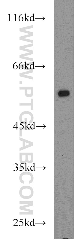 ADRB2 Polyclonal antibody