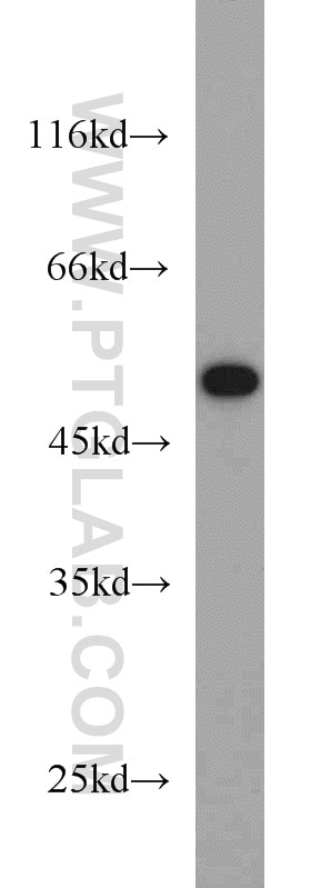 Western Blot (WB) analysis of mouse heart tissue using ADRB2 Polyclonal antibody (13096-1-AP)