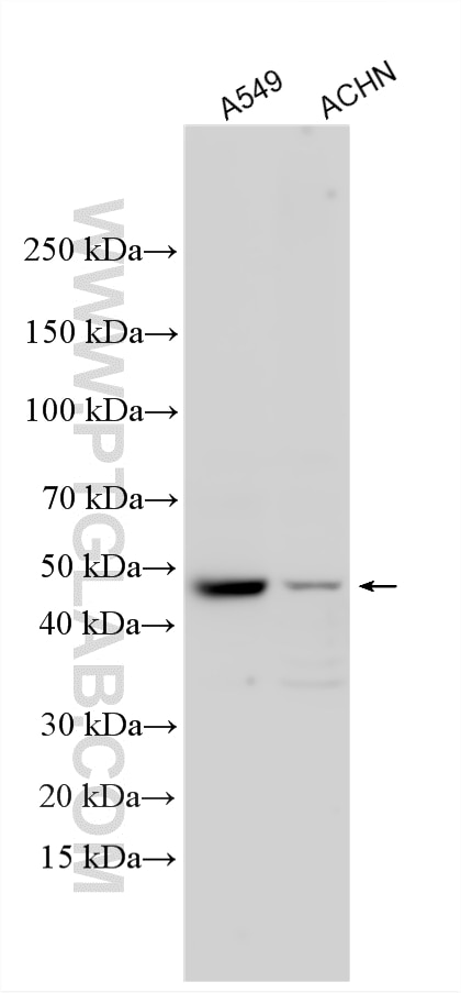 Western Blot (WB) analysis of various lysates using ADRB2 Polyclonal antibody (29864-1-AP)