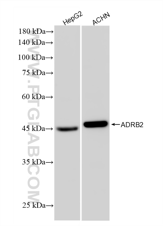 WB analysis using 83317-5-RR Western Blot (WB) analysis of various lysates using ADRB2 Recombinant monoclonal antibody (83317-5-RR)