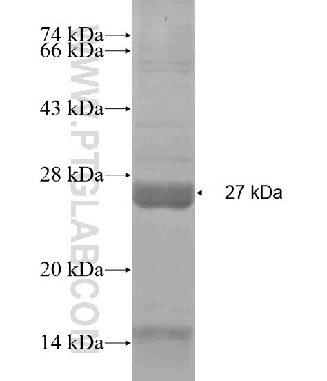 ADRB2 fusion protein Ag18822 SDS-PAGE