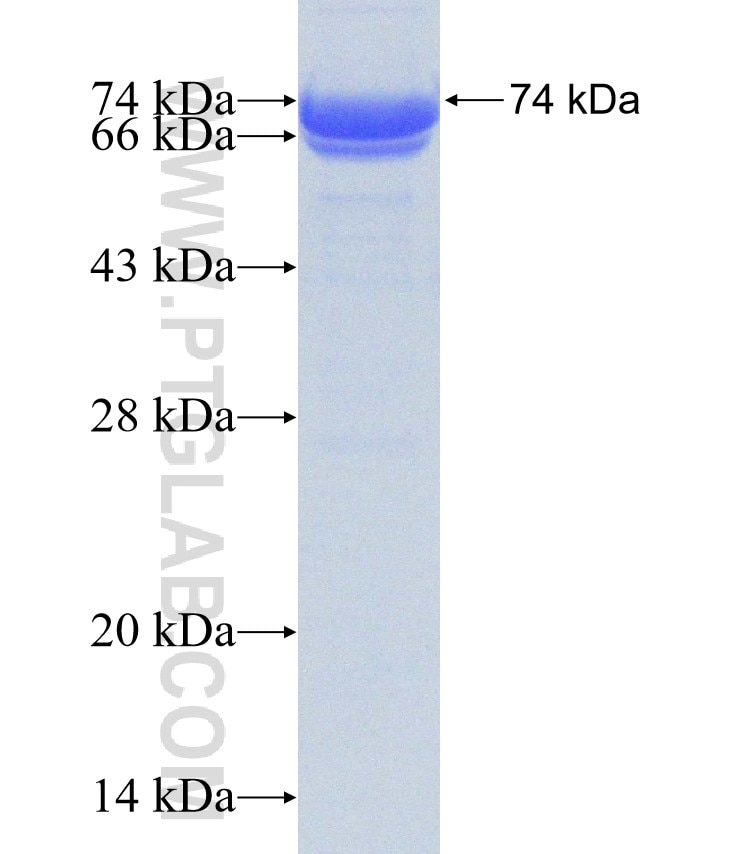 ADRB3 fusion protein Ag31466 SDS-PAGE