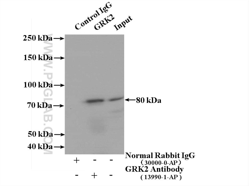 Immunoprecipitation (IP) experiment of HL-60 cells using GRK2 Polyclonal antibody (13990-1-AP)