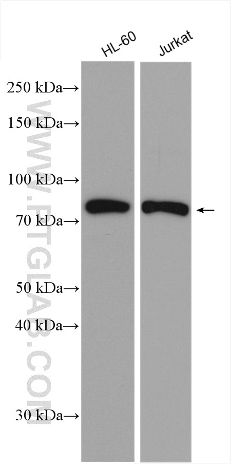 Western Blot (WB) analysis of various lysates using GRK2 Polyclonal antibody (13990-1-AP)