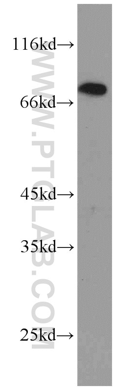 GRK2 Polyclonal antibody