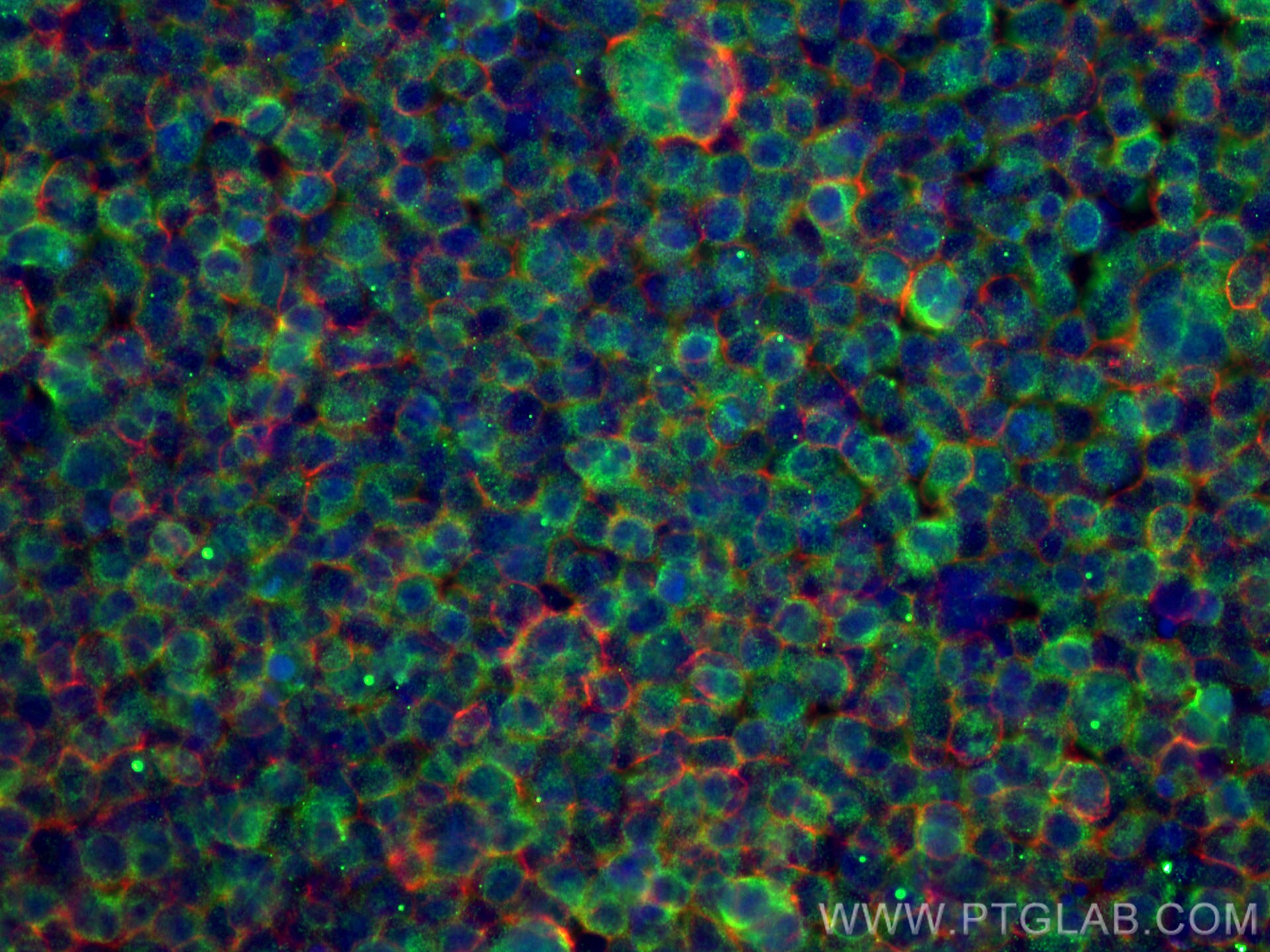 Immunofluorescence (IF) / fluorescent staining of Jurkat cells using ADRBK1 Monoclonal antibody (67067-1-Ig)