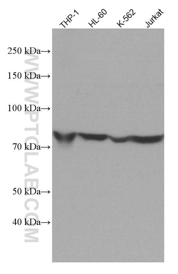 Western Blot (WB) analysis of various lysates using ADRBK1 Monoclonal antibody (67067-1-Ig)