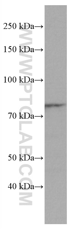 Western Blot (WB) analysis of U-937 cells using ADRBK1 Monoclonal antibody (67067-1-Ig)