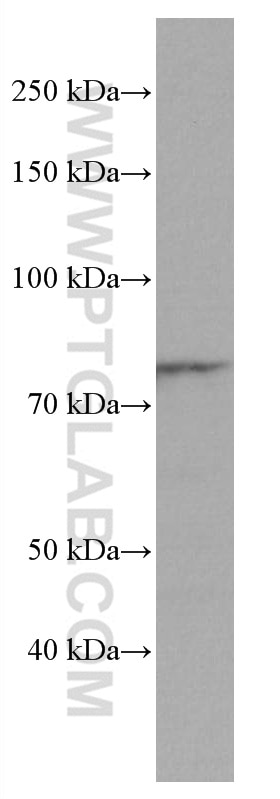 Western Blot (WB) analysis of U-937 cells using ADRBK1 Monoclonal antibody (67067-1-Ig)