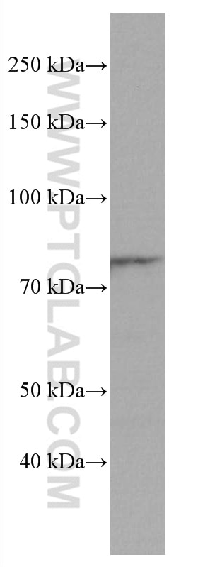 WB analysis of U-937 using 67067-1-Ig