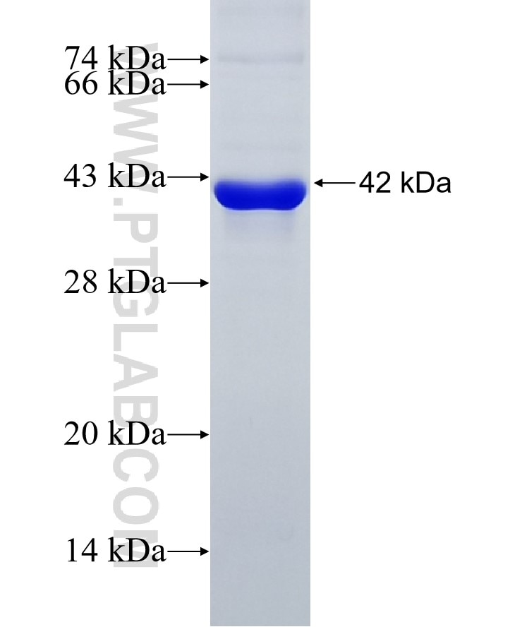 ADRBK1 fusion protein Ag5071 SDS-PAGE