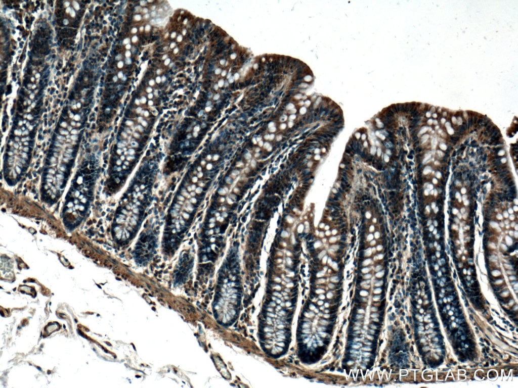 Immunohistochemistry (IHC) staining of human colon tissue using GRK3 Polyclonal antibody (13727-1-AP)