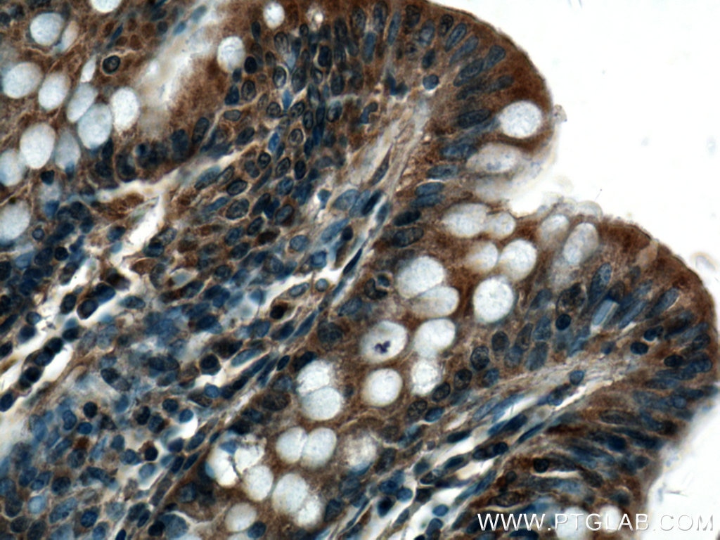Immunohistochemistry (IHC) staining of human colon tissue using GRK3 Polyclonal antibody (13727-1-AP)