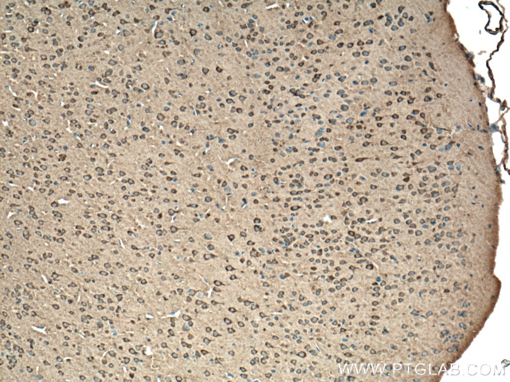 Immunohistochemistry (IHC) staining of mouse brain tissue using GRK3 Polyclonal antibody (13727-1-AP)