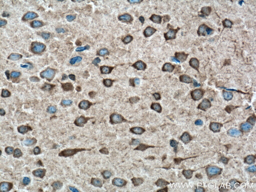 Immunohistochemistry (IHC) staining of mouse brain tissue using GRK3 Polyclonal antibody (13727-1-AP)