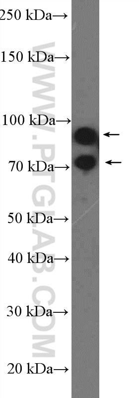 Western Blot (WB) analysis of K-562 cells using GRK3 Polyclonal antibody (13727-1-AP)