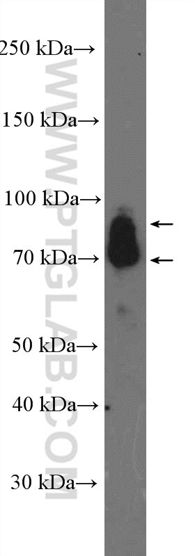 Western Blot (WB) analysis of HL-60 cells using GRK3 Polyclonal antibody (13727-1-AP)