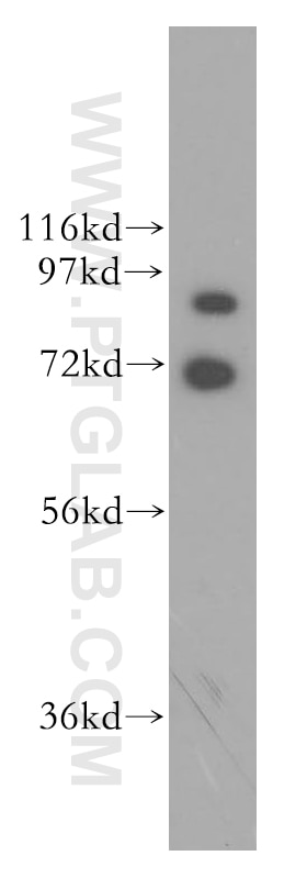 Western Blot (WB) analysis of K-562 cells using GRK3 Polyclonal antibody (13727-1-AP)