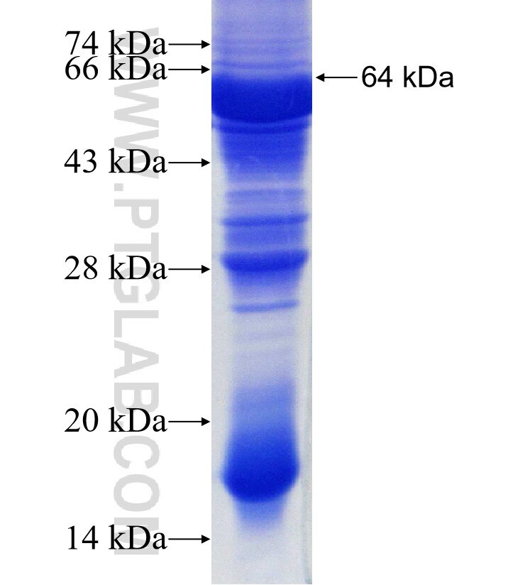 ADRBK2 fusion protein Ag4685 SDS-PAGE