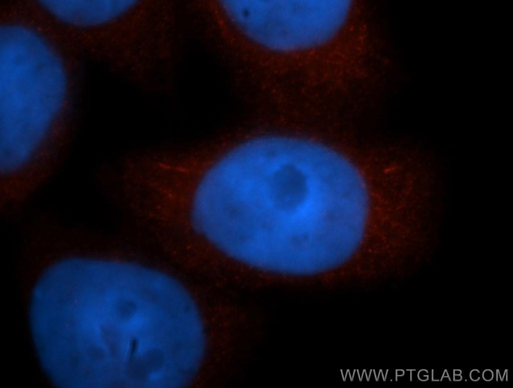 Immunofluorescence (IF) / fluorescent staining of MCF-7 cells using ADRM1 Polyclonal antibody (11468-1-AP)