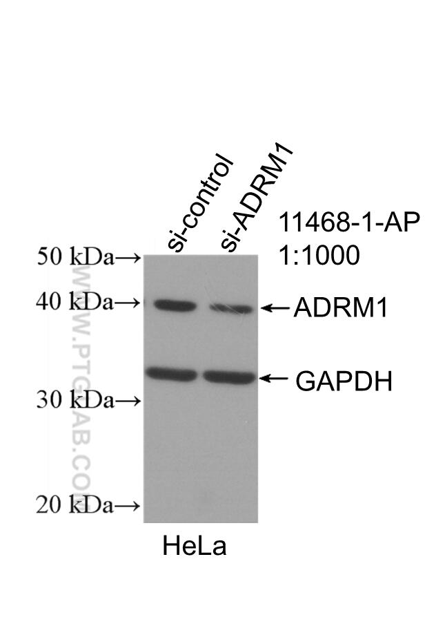 Western Blot (WB) analysis of HeLa cells using ADRM1 Polyclonal antibody (11468-1-AP)