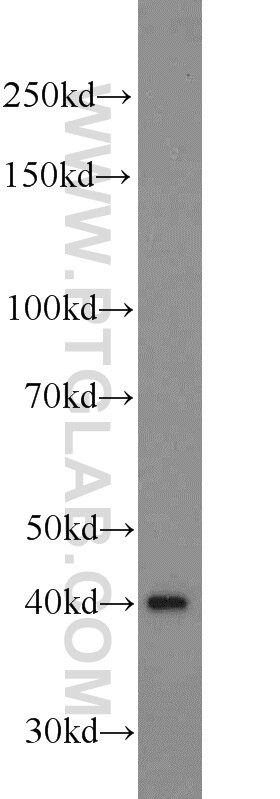 Western Blot (WB) analysis of HeLa cells using ADRM1 Polyclonal antibody (11468-1-AP)