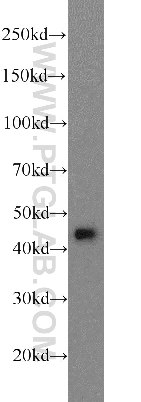 Western Blot (WB) analysis of HEK-293 cells using ADRM1 Polyclonal antibody (11468-1-AP)
