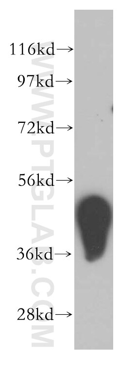 Western Blot (WB) analysis of mouse testis tissue using ADRM1 Polyclonal antibody (11468-1-AP)