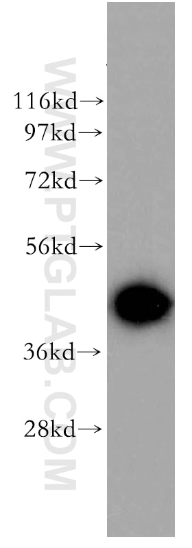 Western Blot (WB) analysis of mouse ovary tissue using ADRM1 Polyclonal antibody (11468-1-AP)