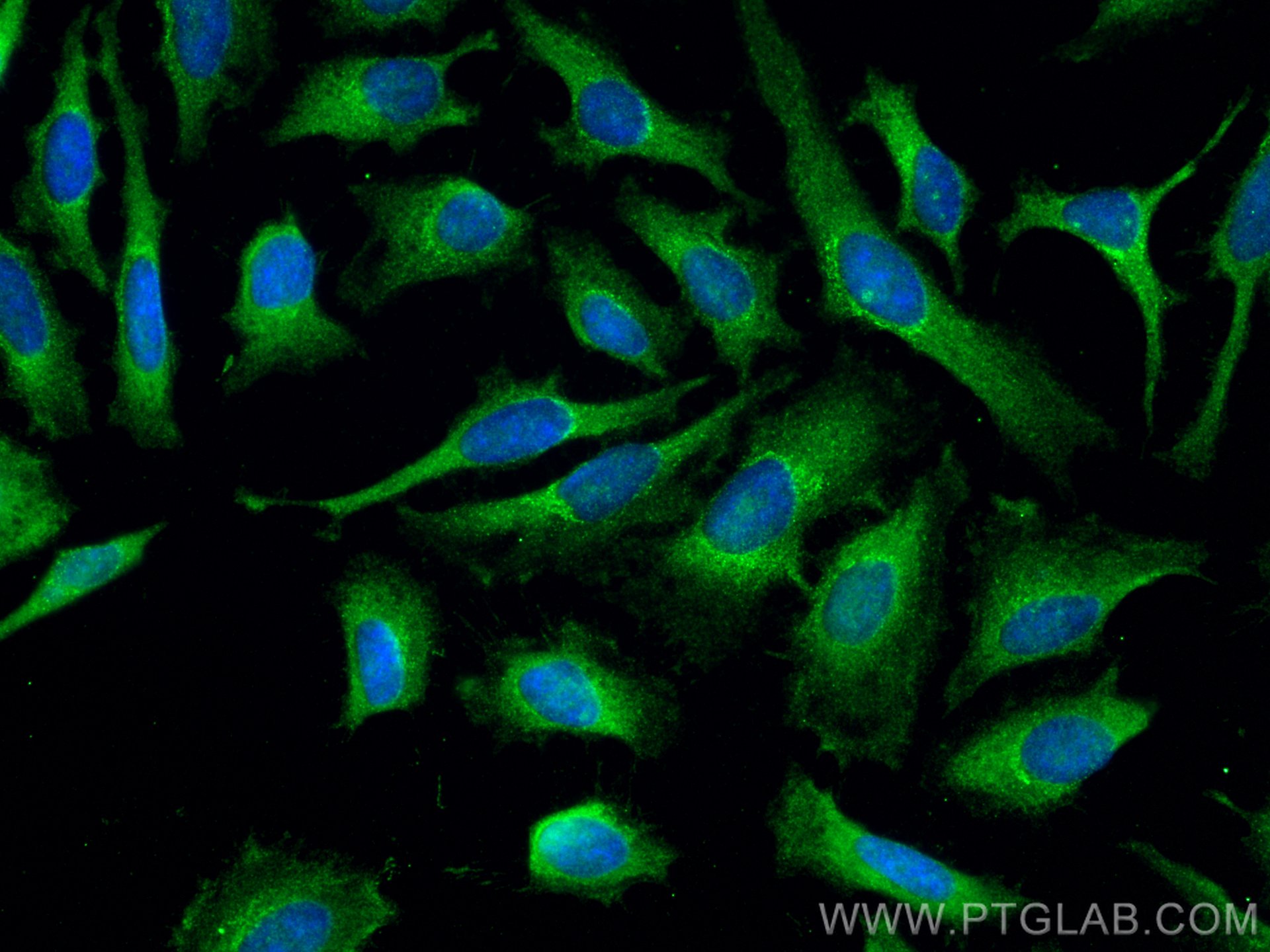 Immunofluorescence (IF) / fluorescent staining of HeLa cells using ADRM1 Monoclonal antibody (66464-1-Ig)