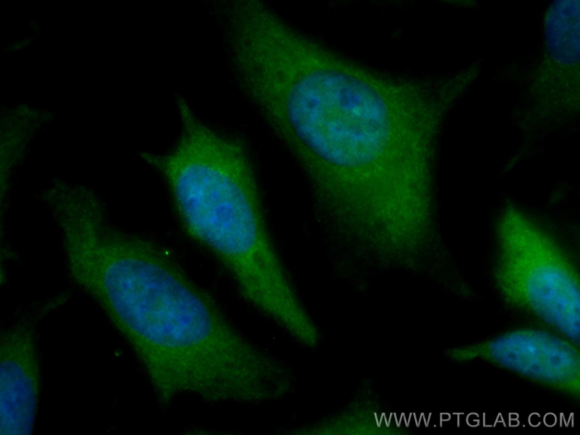 Immunofluorescence (IF) / fluorescent staining of HeLa cells using CoraLite® Plus 488-conjugated ADRM1 Monoclonal ant (CL488-66464)