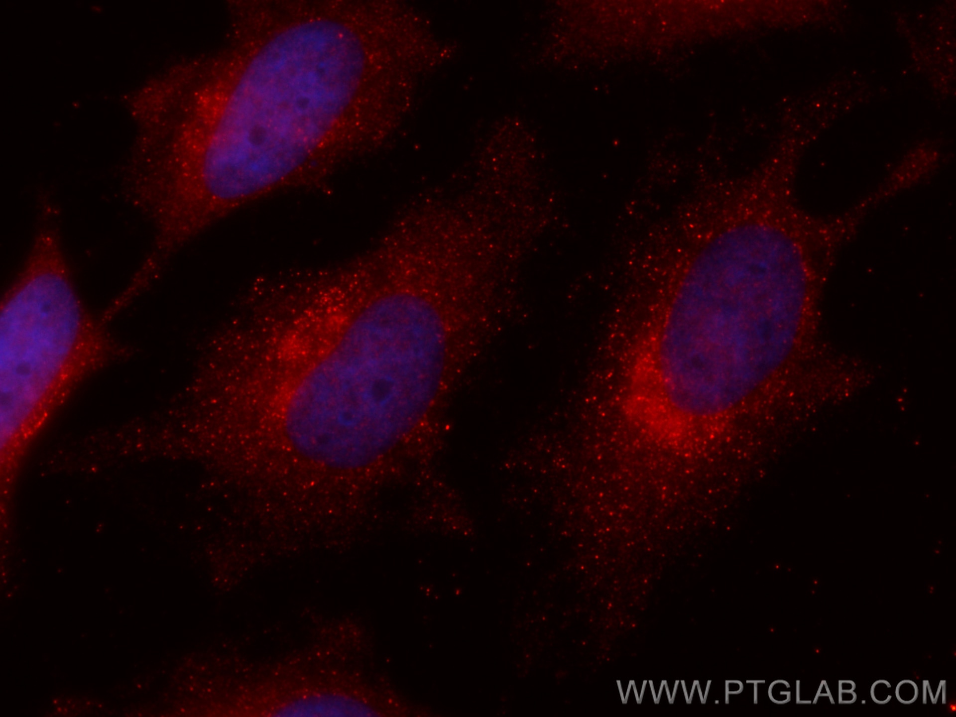 Immunofluorescence (IF) / fluorescent staining of HeLa cells using CoraLite®594-conjugated ADRM1 Monoclonal antibody (CL594-66464)