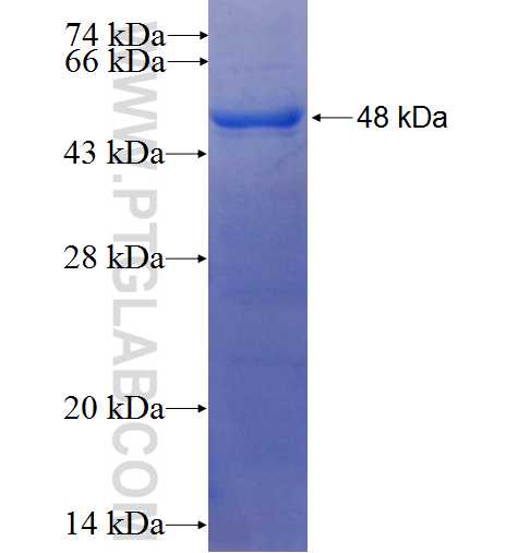 ADRM1 fusion protein Ag24699 SDS-PAGE