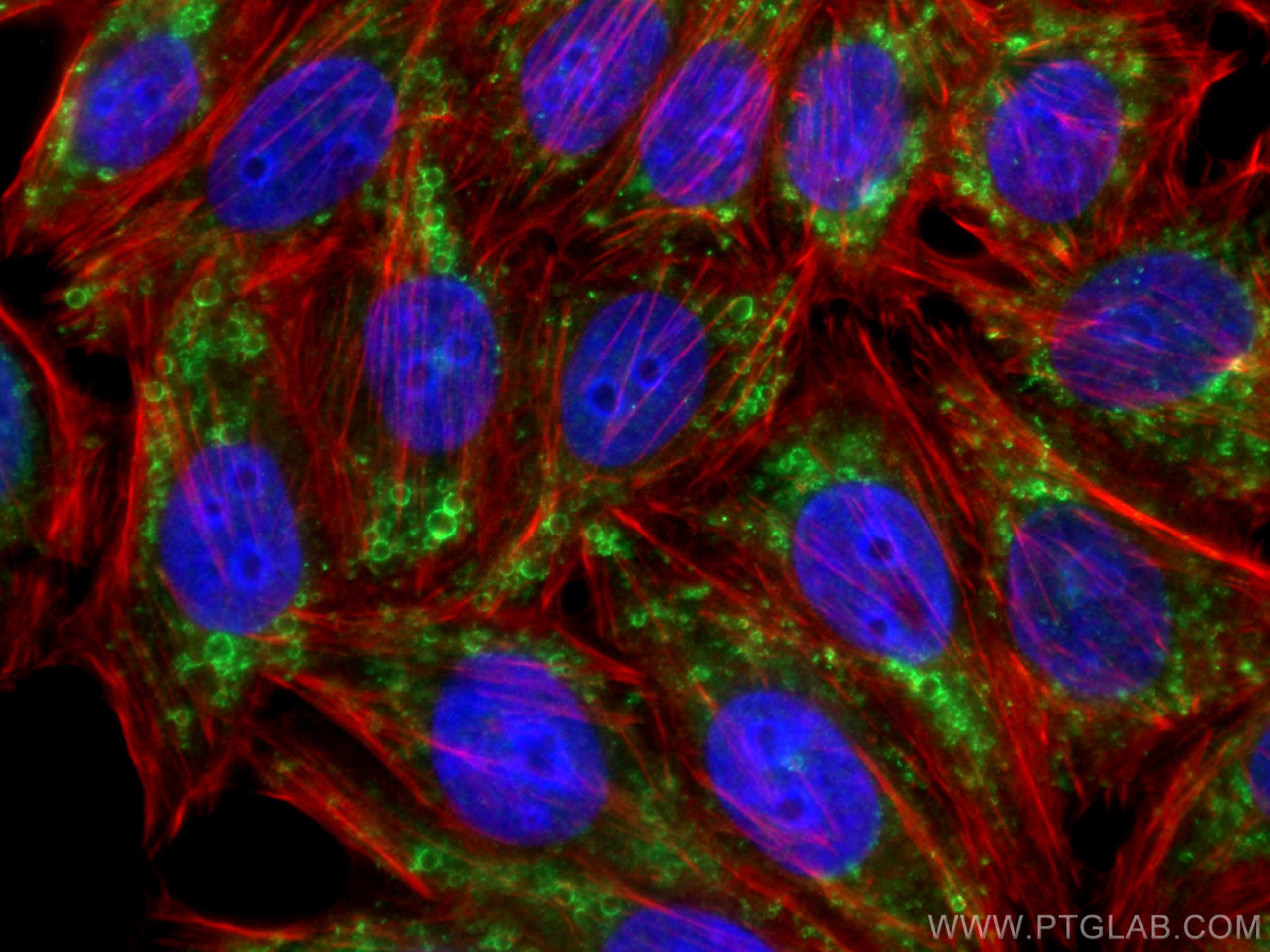 Immunofluorescence (IF) / fluorescent staining of HepG2 cells using ADRP/Perilipin 2 Polyclonal antibody (15294-1-AP)