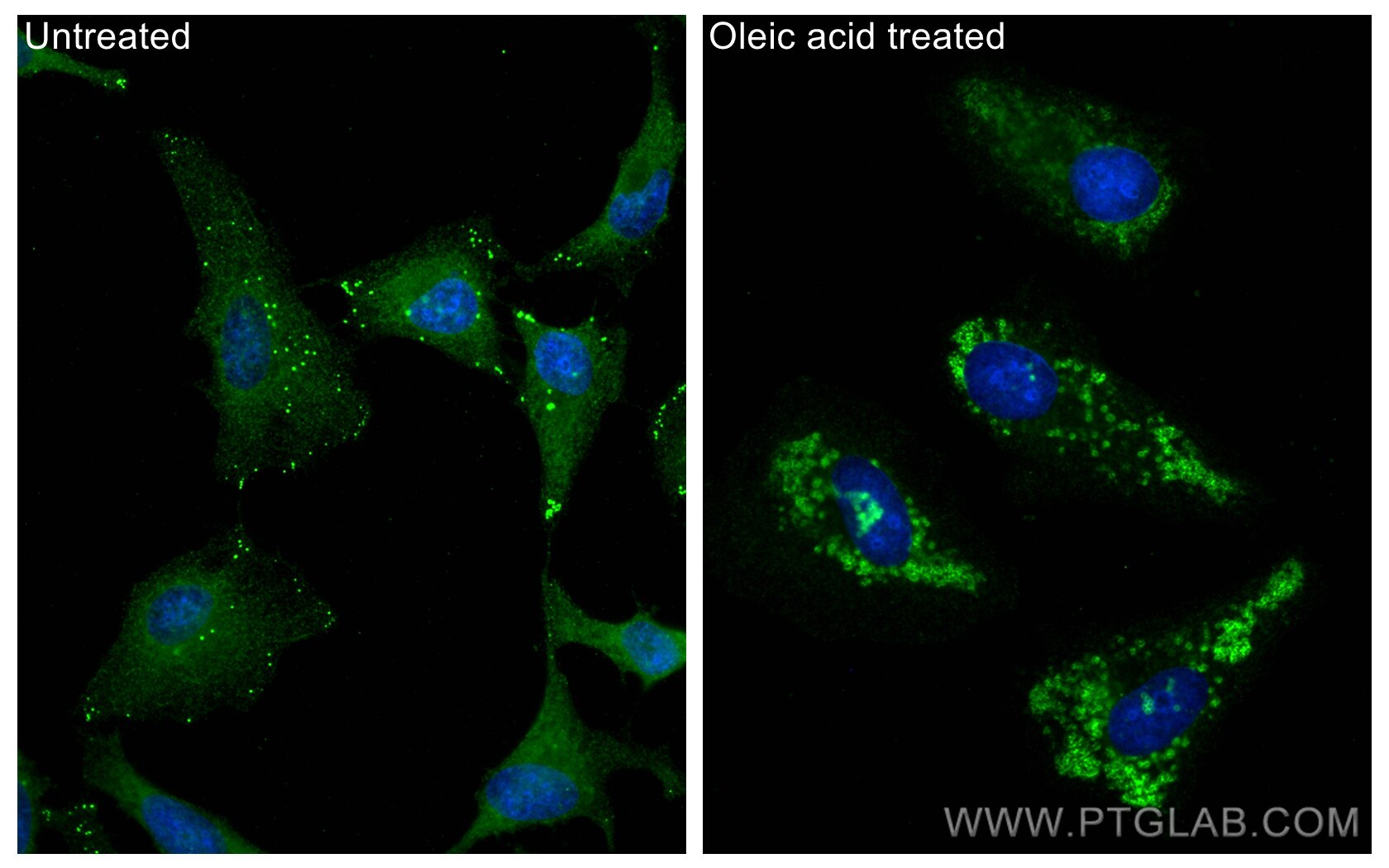 Immunofluorescence (IF) / fluorescent staining of HeLa cells using ADRP/Perilipin 2 Polyclonal antibody (15294-1-AP)