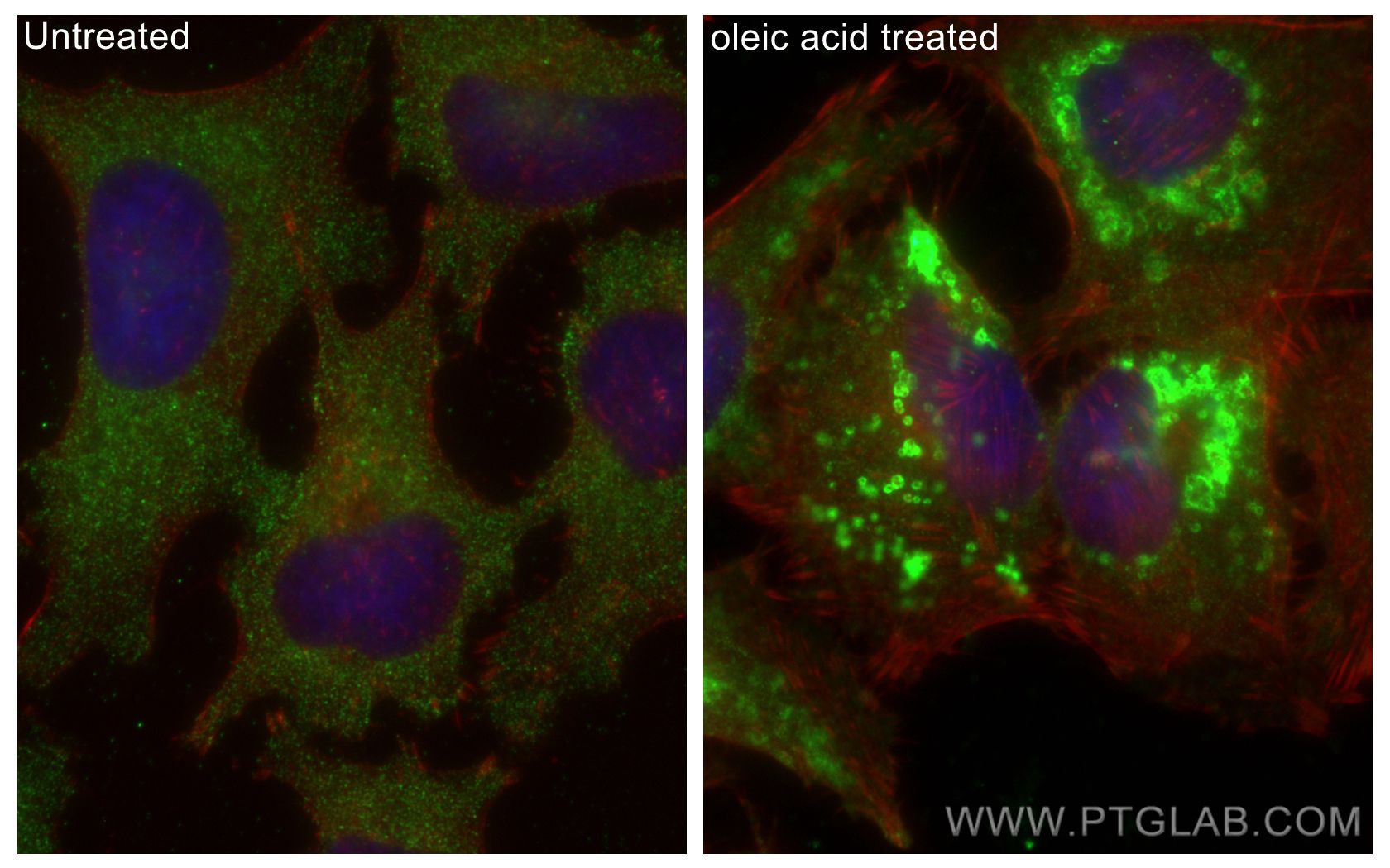 Immunofluorescence (IF) / fluorescent staining of HeLa cells using ADRP/Perilipin 2 Polyclonal antibody (15294-1-AP)