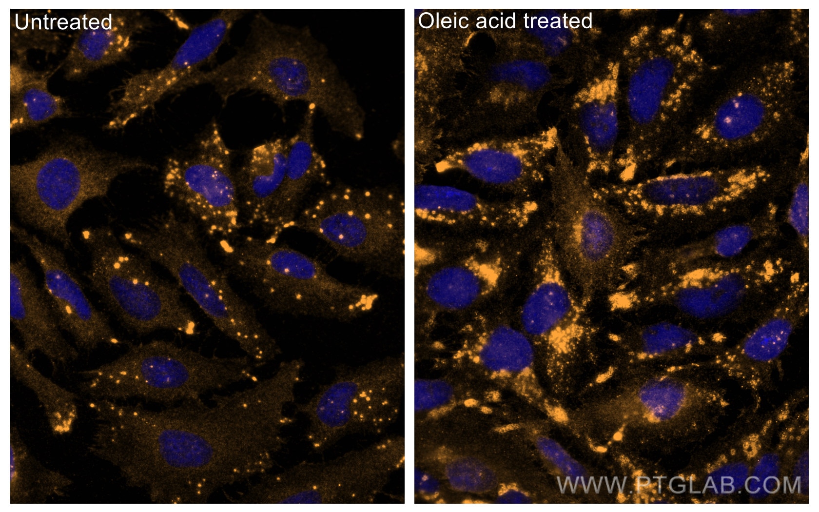 Immunofluorescence (IF) / fluorescent staining of HeLa cells using ADRP/Perilipin 2 Polyclonal antibody (15294-1-AP)