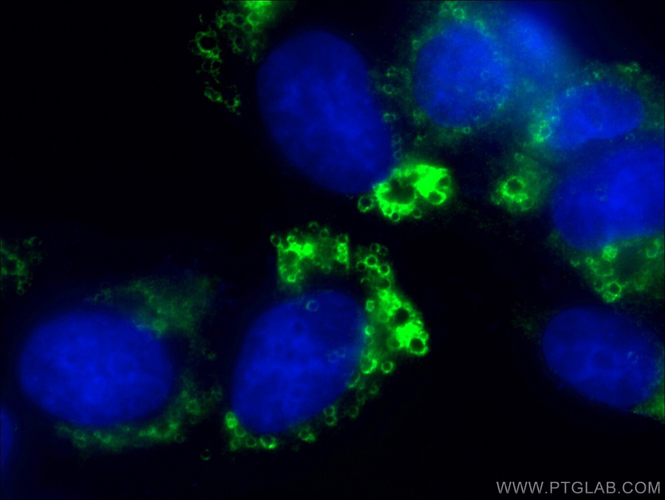 ADRP/Perilipin-2 Polyclonal antibody