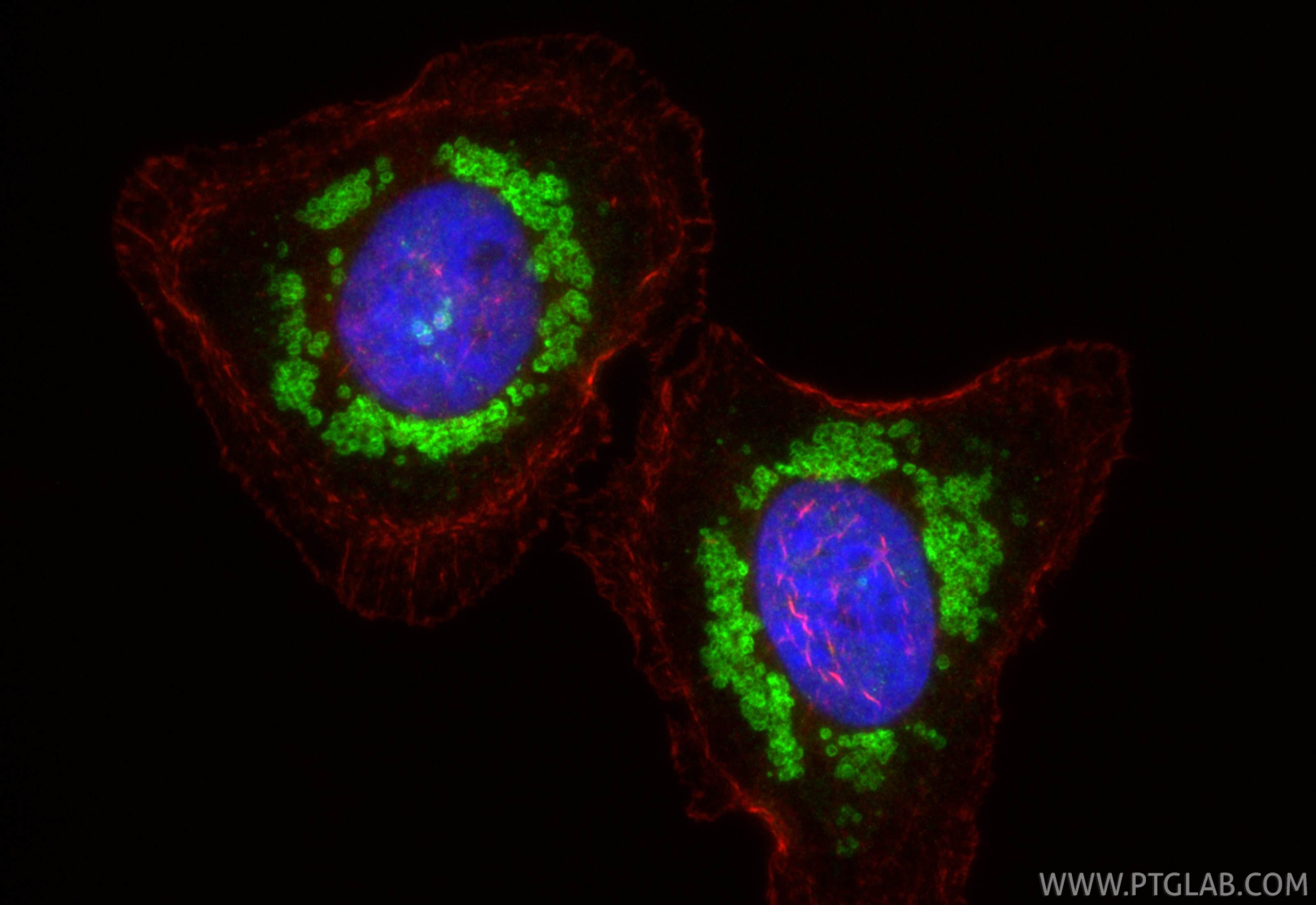 Immunofluorescence (IF) / fluorescent staining of HeLa cells using Perilipin-2 Polyclonal antibody (15294-1-AP)