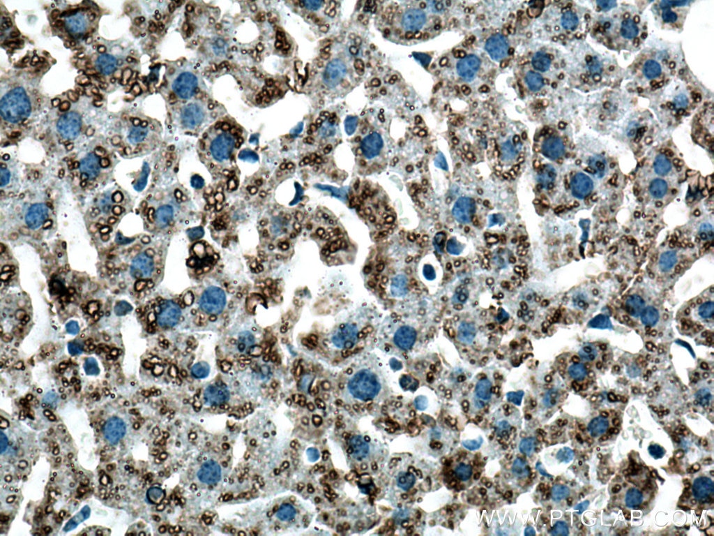 Immunohistochemistry (IHC) staining of mouse liver tissue using ADRP/Perilipin 2 Polyclonal antibody (15294-1-AP)