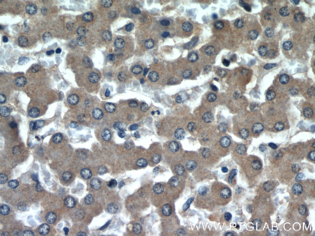 Immunohistochemistry (IHC) staining of human liver tissue using ADRP/Perilipin 2 Polyclonal antibody (15294-1-AP)