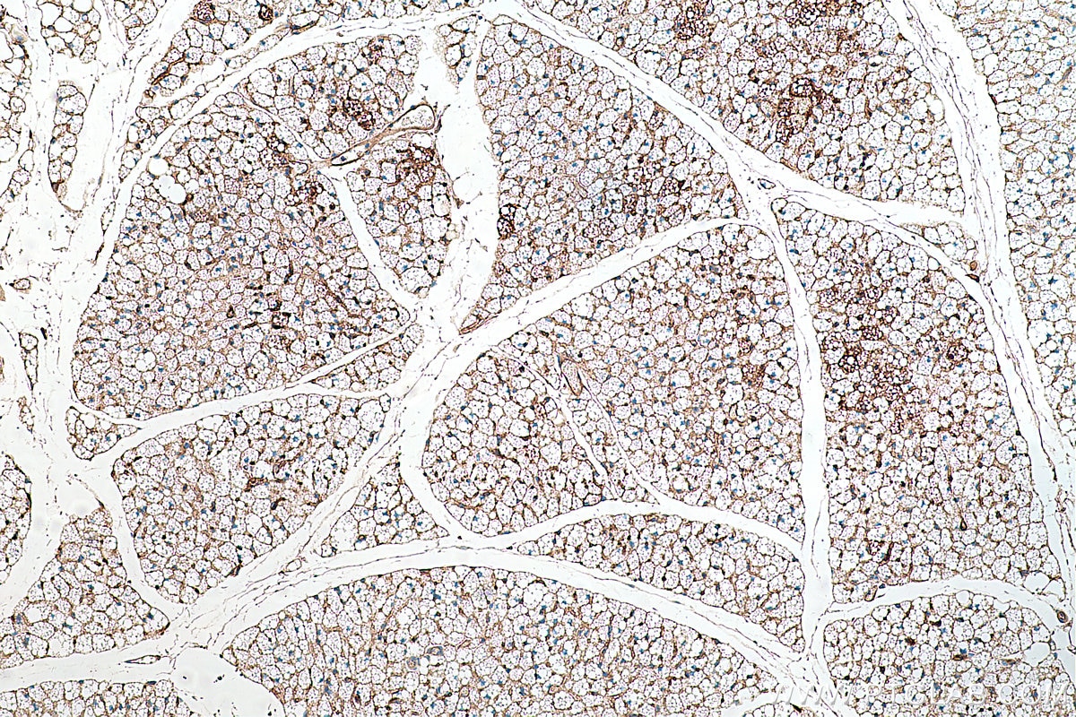 Immunohistochemistry (IHC) staining of mouse brown adipose tissue using ADRP/Perilipin 2 Monoclonal antibody (60340-1-Ig)