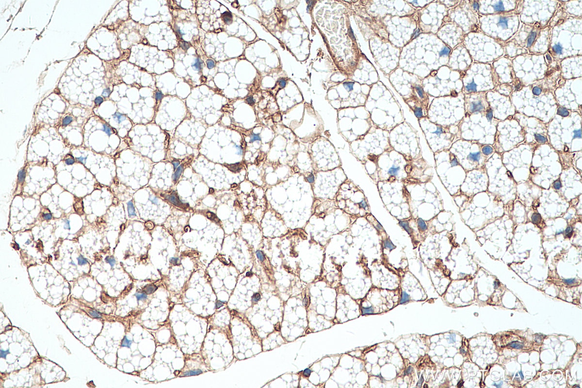Immunohistochemistry (IHC) staining of mouse brown adipose tissue using ADRP/Perilipin 2 Monoclonal antibody (60340-1-Ig)