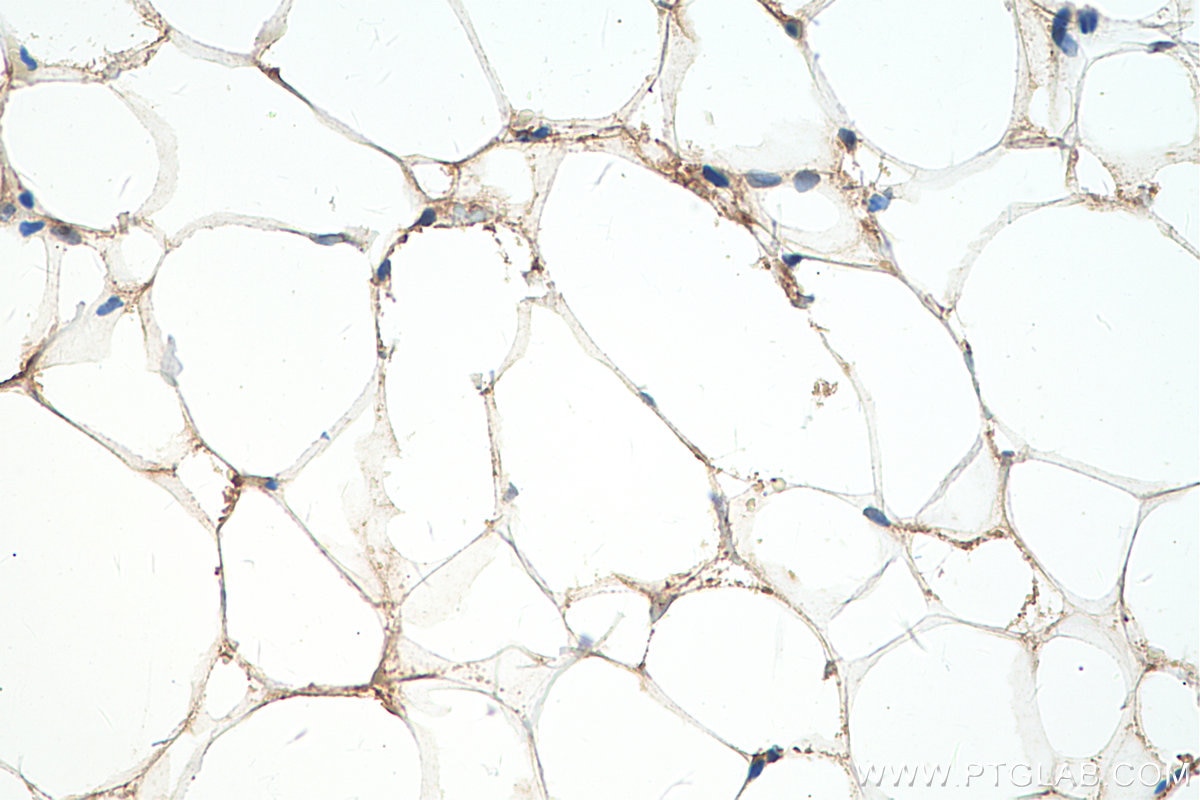 Immunohistochemistry (IHC) staining of rat brown adipose tissue using ADRP/Perilipin 2 Monoclonal antibody (60340-1-Ig)
