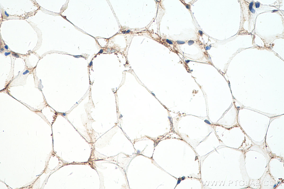 Immunohistochemistry (IHC) staining of rat brown adipose tissue using Perilipin-2 Monoclonal antibody (60340-1-Ig)