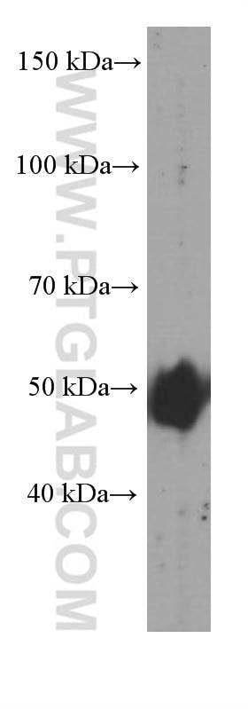 Western Blot (WB) analysis of human adipose tissue using ADRP/Perilipin 2 Monoclonal antibody (60340-1-Ig)