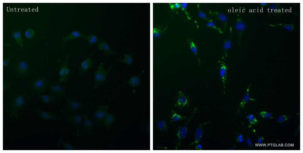 IF Staining of HeLa using 80362-2-RR