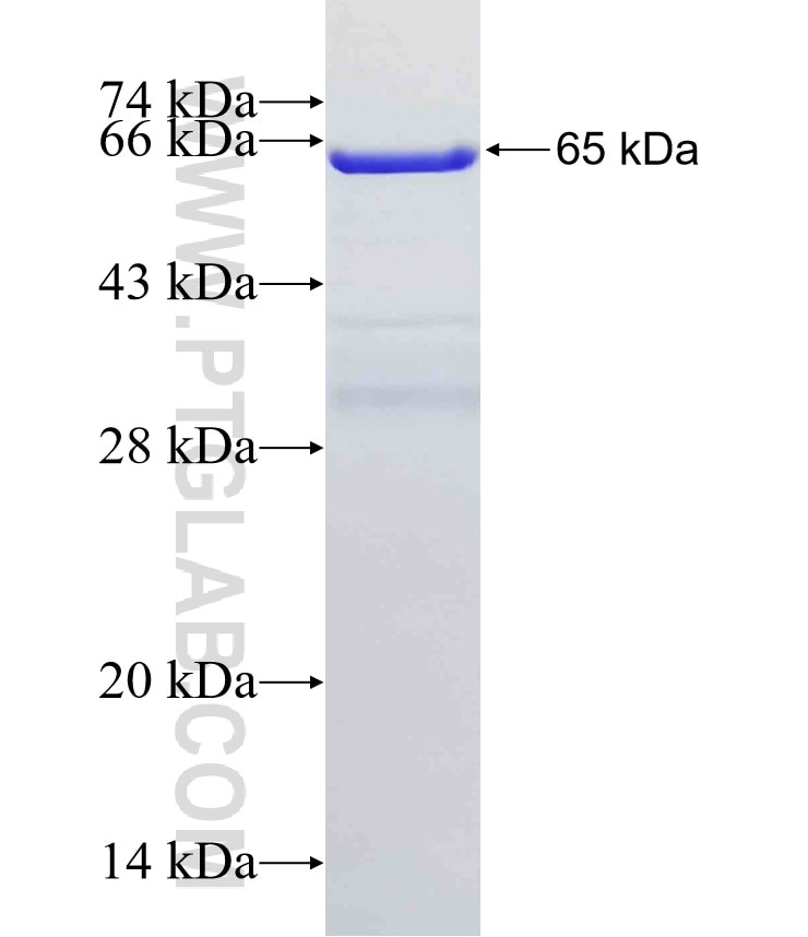 ADRP fusion protein Ag7539 SDS-PAGE
