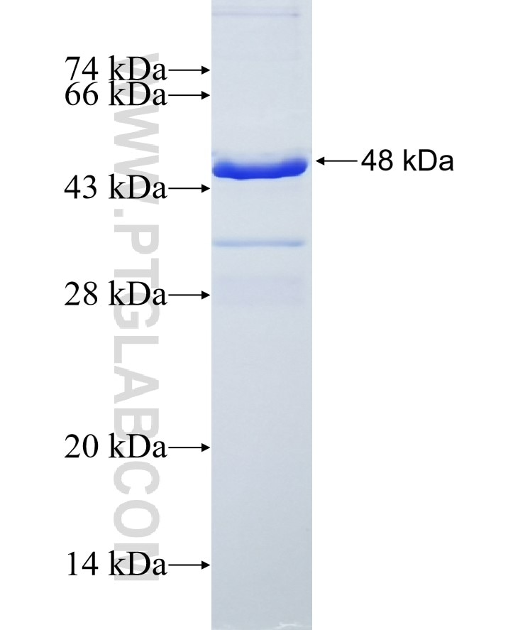 ADRP fusion protein Ag7643 SDS-PAGE