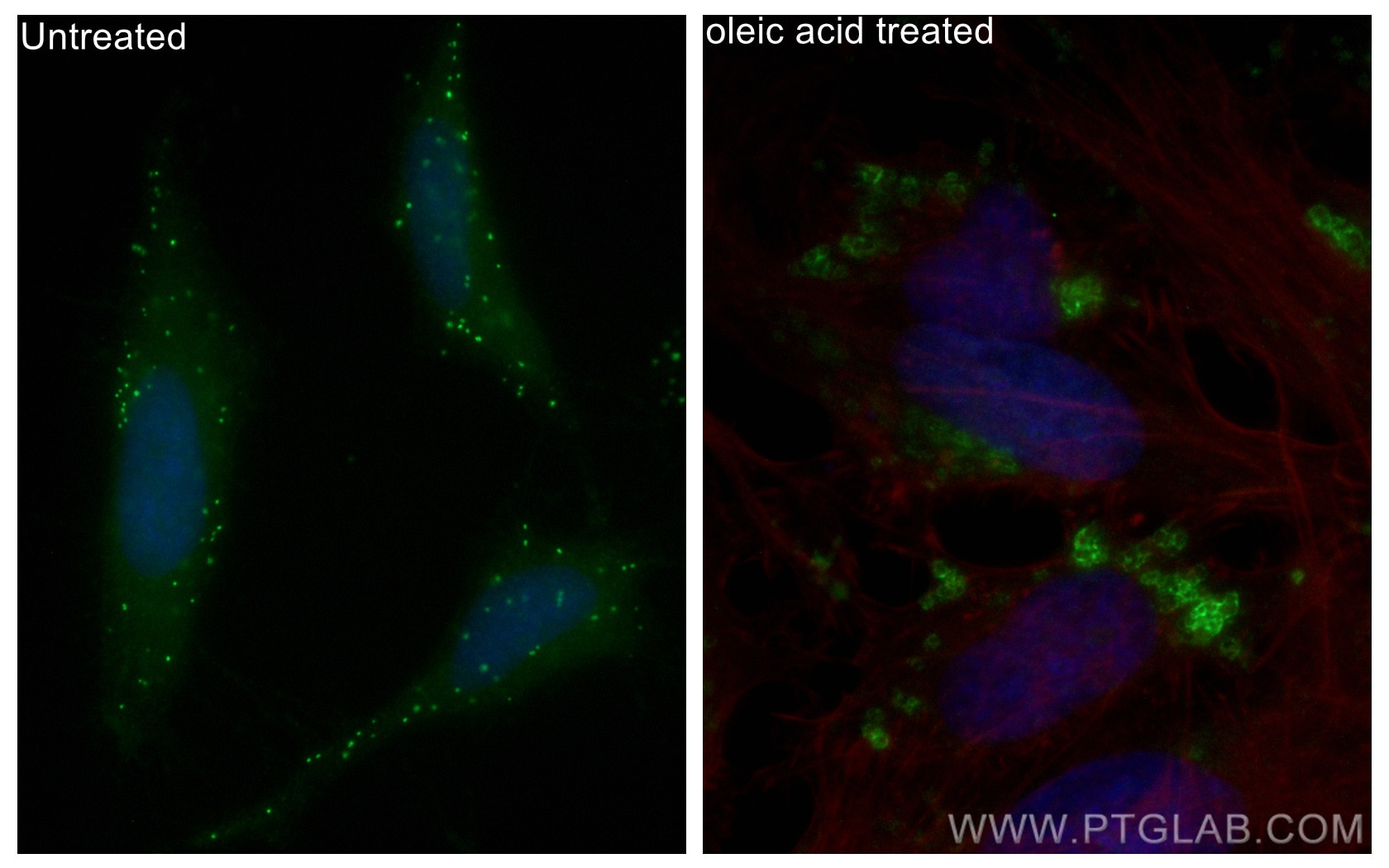 Immunofluorescence (IF) / fluorescent staining of HeLa cells using CoraLite® Plus 488-conjugated ADRP/Perilipin 2 Pol (CL488-15294)